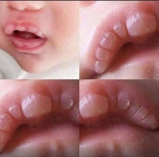 Baby Teething: Signs, Comfort Tips, and When to Talk to a Doctor