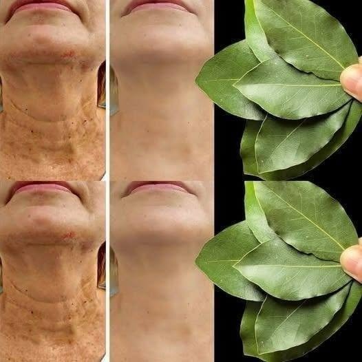 Bay Leaves & Skin Health: Can This Kitchen Herb Support Aging Skin?