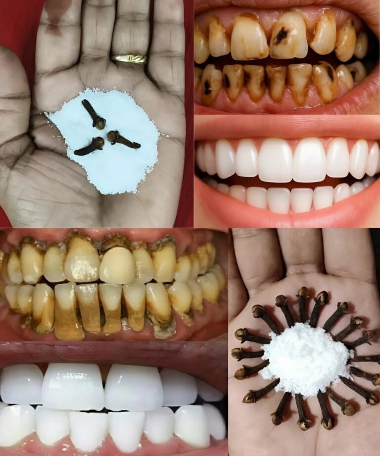 Discover the Natural Power of Cloves: A Daily Habit for Stronger Teeth and Fresher Breath
