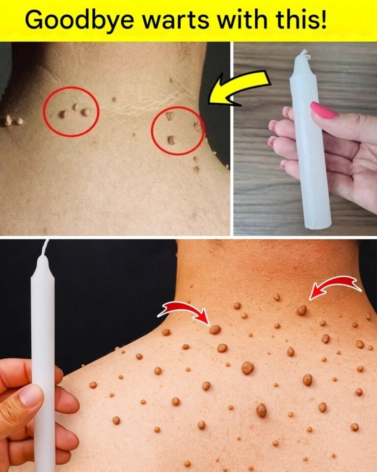 Say Goodbye to Warts Naturally? What Really Works and What to Avoid