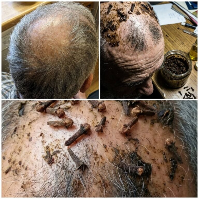 Can Clove Oil Help Hair Grow on Bald Spots? Here's What the Evidence Says
