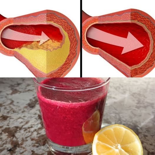 Beetroot Juice: A Refreshing Drink That May Support Heart Health