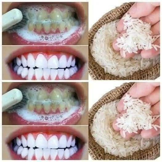 DIY Teeth Whitening With Baking Soda and Lemon: What Works, What Doesn’t, and Safer Ways to Brighten Your Smile