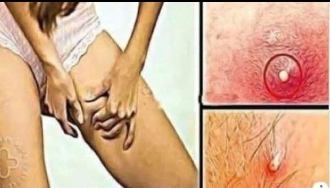 Do Skin Dots Mean Cancer? Understanding Viral Health Claims and Cabbage Leaf Remedies