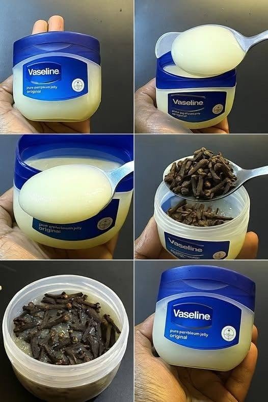 Cloves and Petroleum Jelly: A Simple DIY Skin Balm and What It Can (and Can't) Do