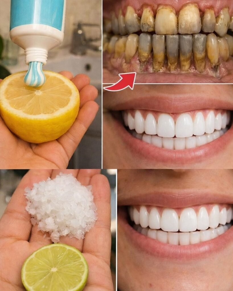 Natural Teeth Whitening at Home: Safe Ways to Brighten Your Smile and Improve Oral Health