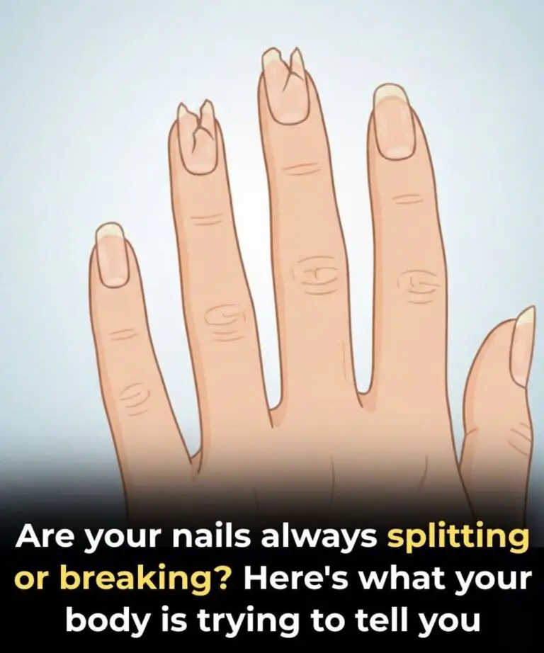 If Your Nails Look Like This, It’s Time for a Check-Up