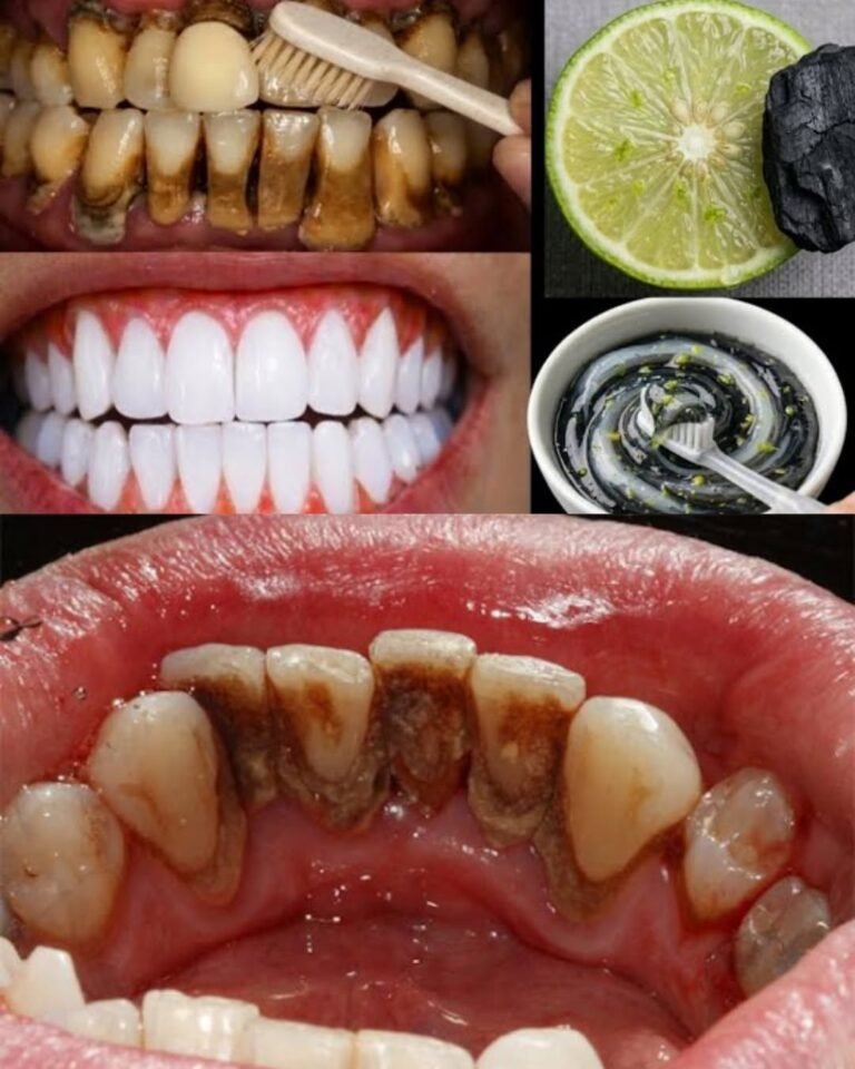 A Guide to Naturally Whitening Yellow Teeth at Home with Banana, Ginger, and Lemon Ingredients