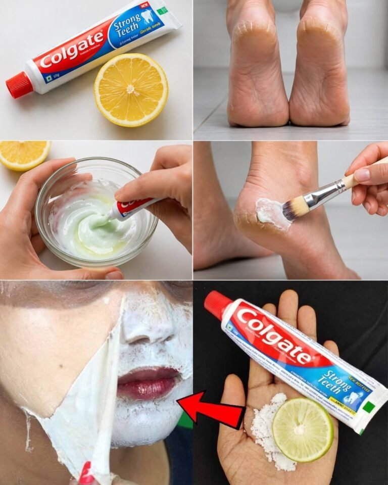 Transform Your Cracked Heels with The Magic of Lemon and Toothpaste Remedies