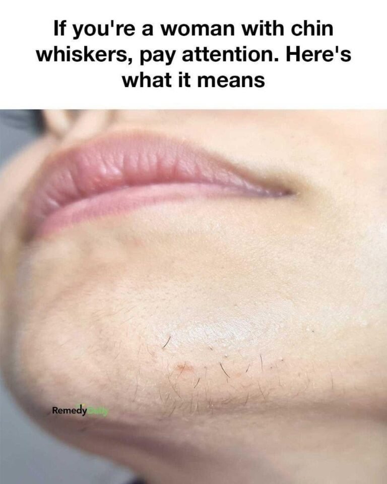 Chin Hair in Women: What’s Normal, What’s Not, and How to Handle It Without Shame