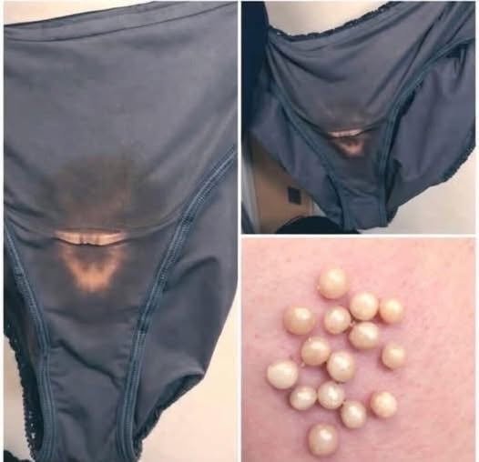Bleach-Like Spots in Your Underwear? Here's What They Usually Mean