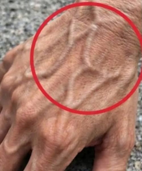 Visible Hand Veins: Common Causes, What They Mean, and When to See a Doctor