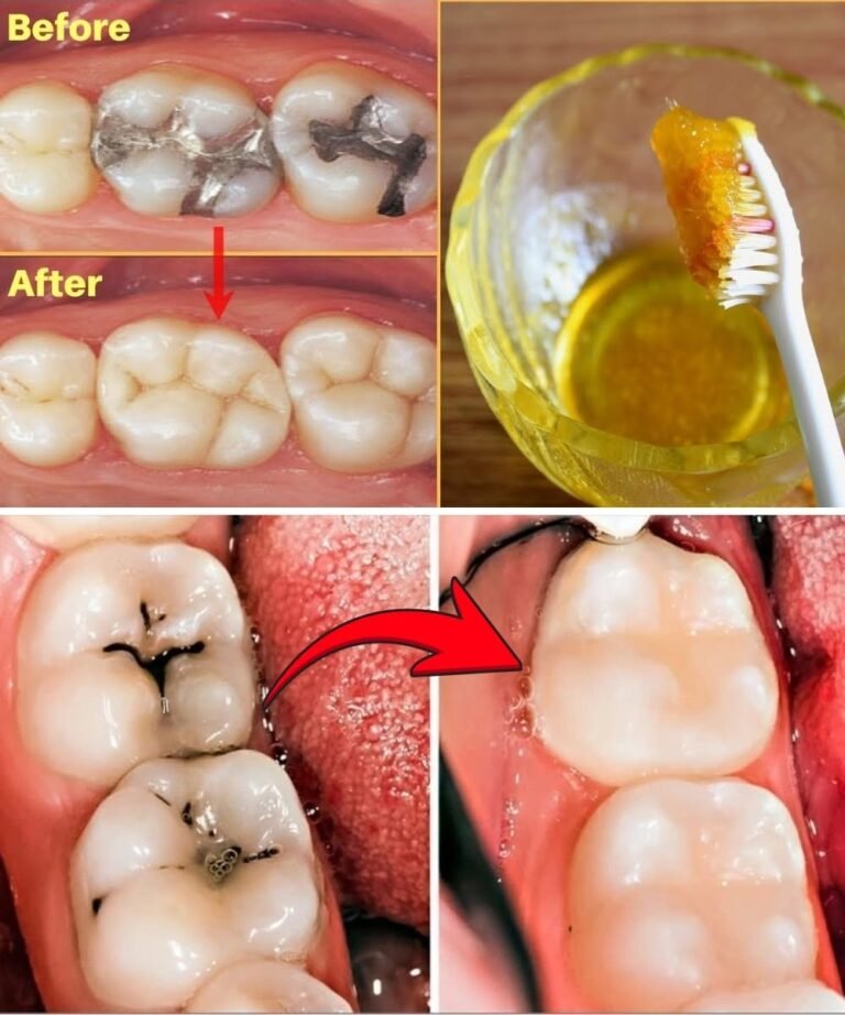 The “Miracle” Tooth Photos – What’s Real? 🦷