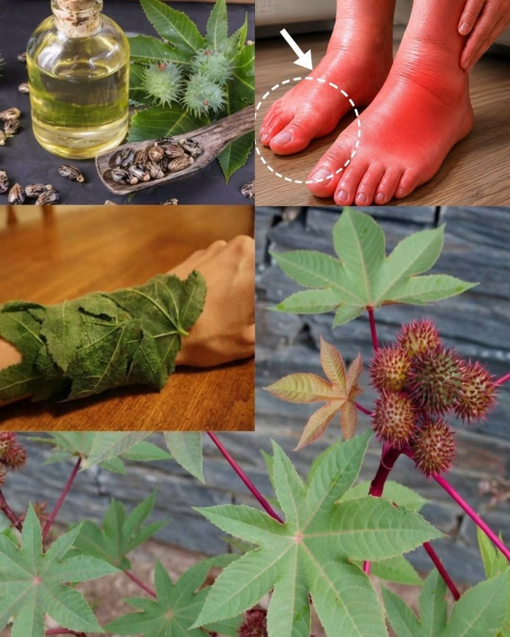 How to Prepare and Use a Castor Oil Compress for Swollen Joints