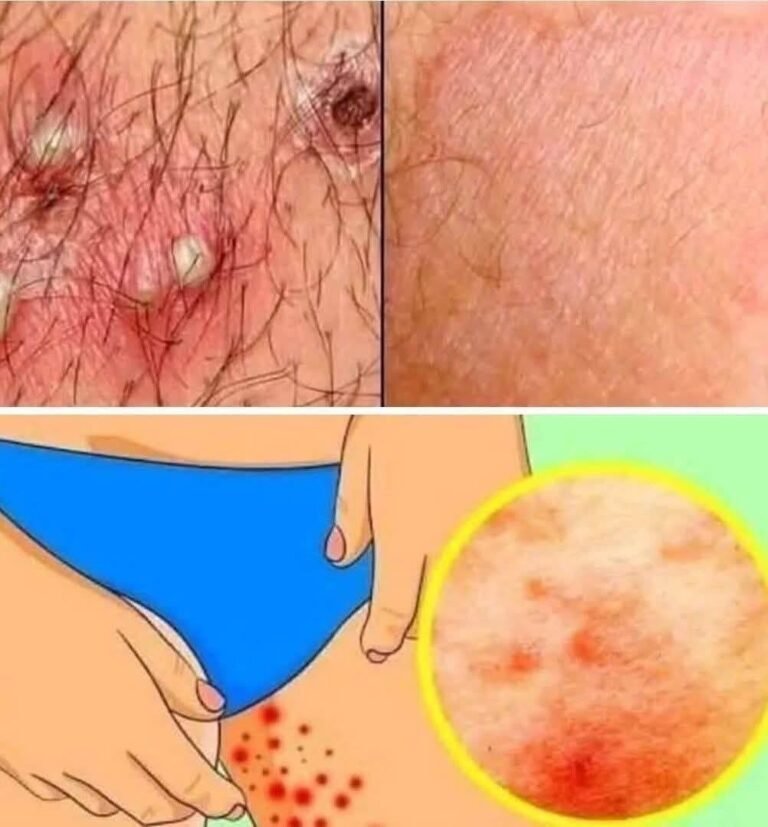 Painful Bump in the Groin? Here's One Common Cause Many People Overlook