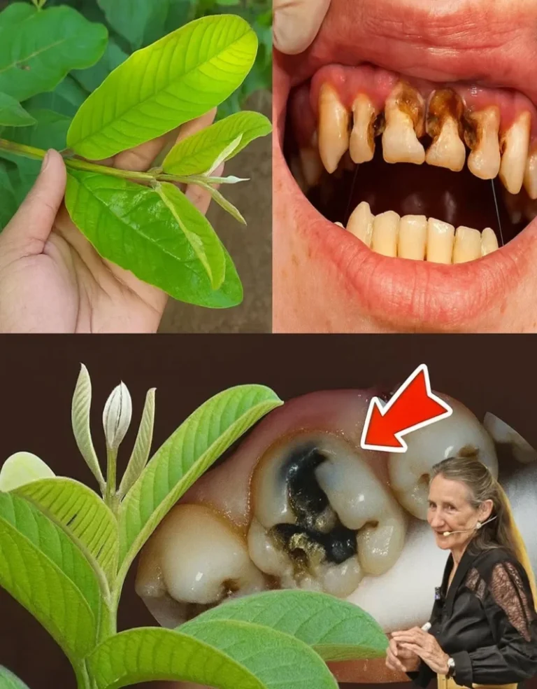 Top 3 Ways to Treat Tooth Decay with Guava Leaves: Simple and Cost-Effective