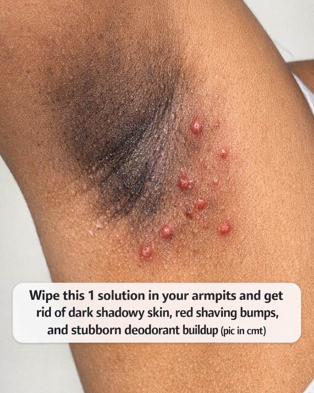 Dark Underarms? How Glycolic Acid May Help Reduce Discoloration, Razor Bumps, and Deodorant Build-Up