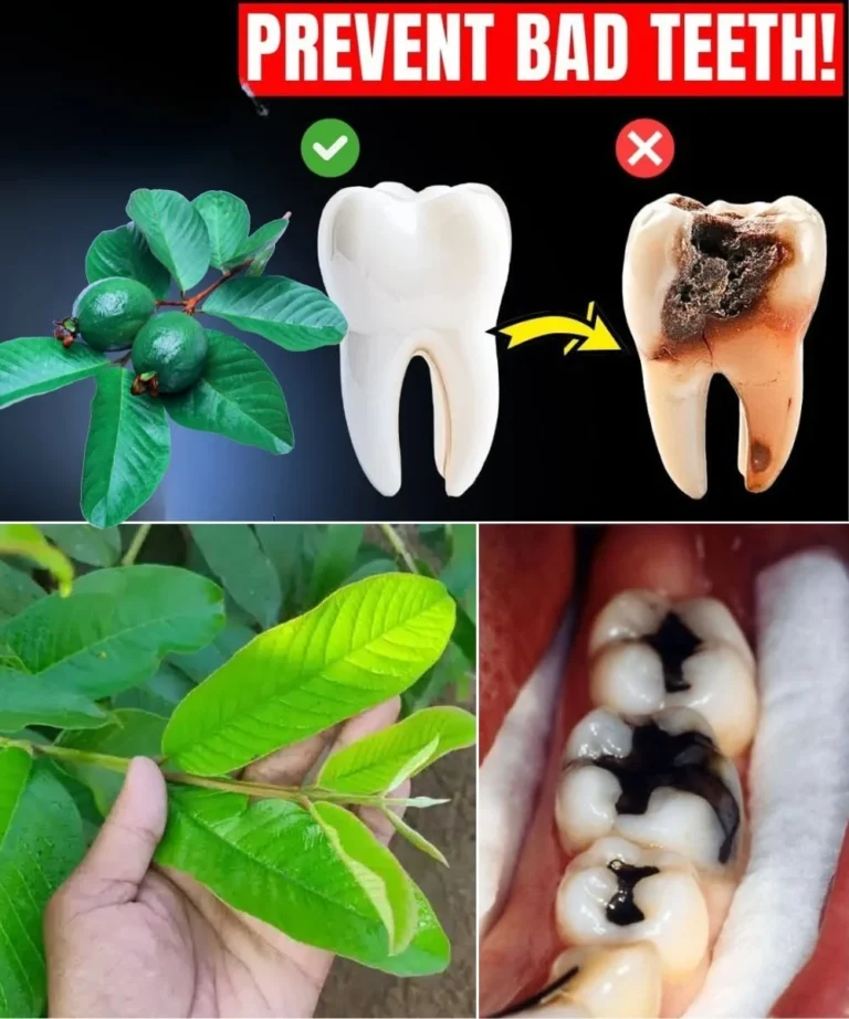 Top 3 Ways to Treat Tooth Decay with Guava Leaves – Simple and Cost-Effective