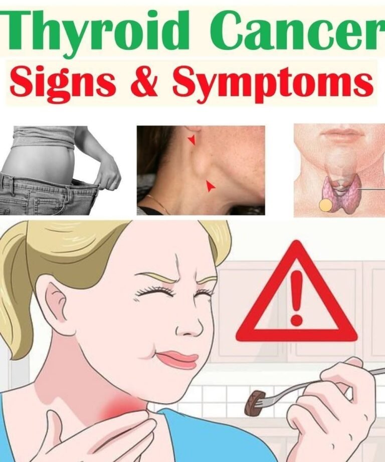 10 Urgent Signs Your Thyroid May Be in Trouble: Symptoms You Should Never Ignore