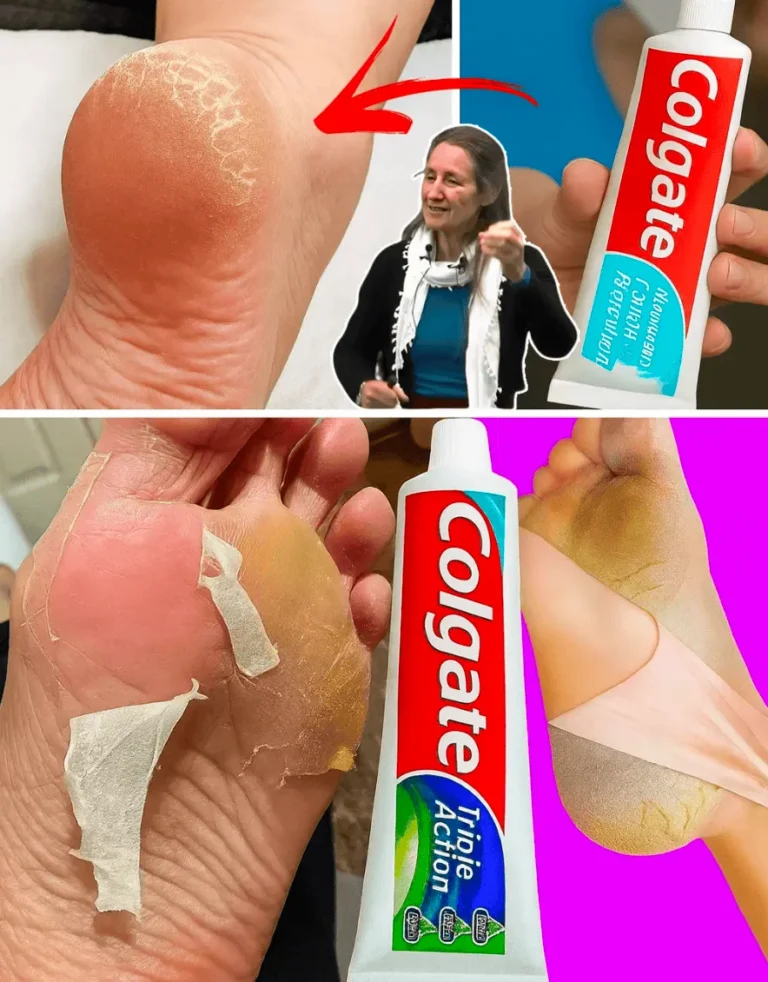 👣 Say Goodbye to Cracked Heels: Irresistible Home Remedies for Silky, Smooth Feet!