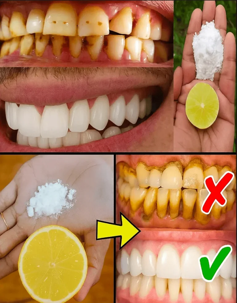 The Truth About Lemon and Baking Soda for a Radiant Smile