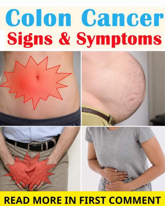 Colon Cancer Signs on the Skin: 3 Warning Changes You Shouldn’t Ignore
