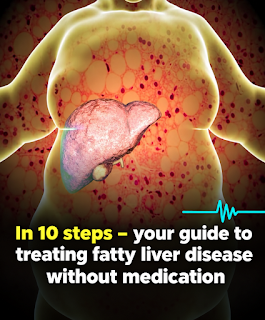 The Liver Reset Protocol: 10 Natural Lifestyle Habits That May Help Reduce Fatty Liver