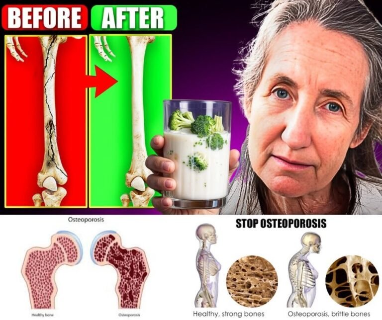 STOP Osteoporosis NOW: THIS HEALS Your Bones Fast!