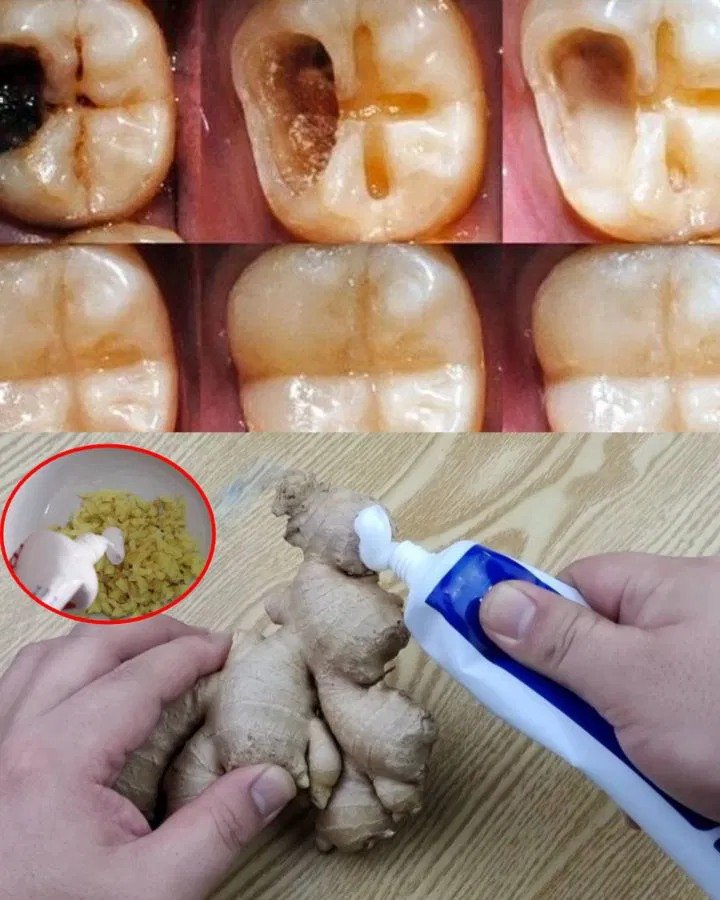 How to Naturally Repair a Cavity: Fact or Fiction?