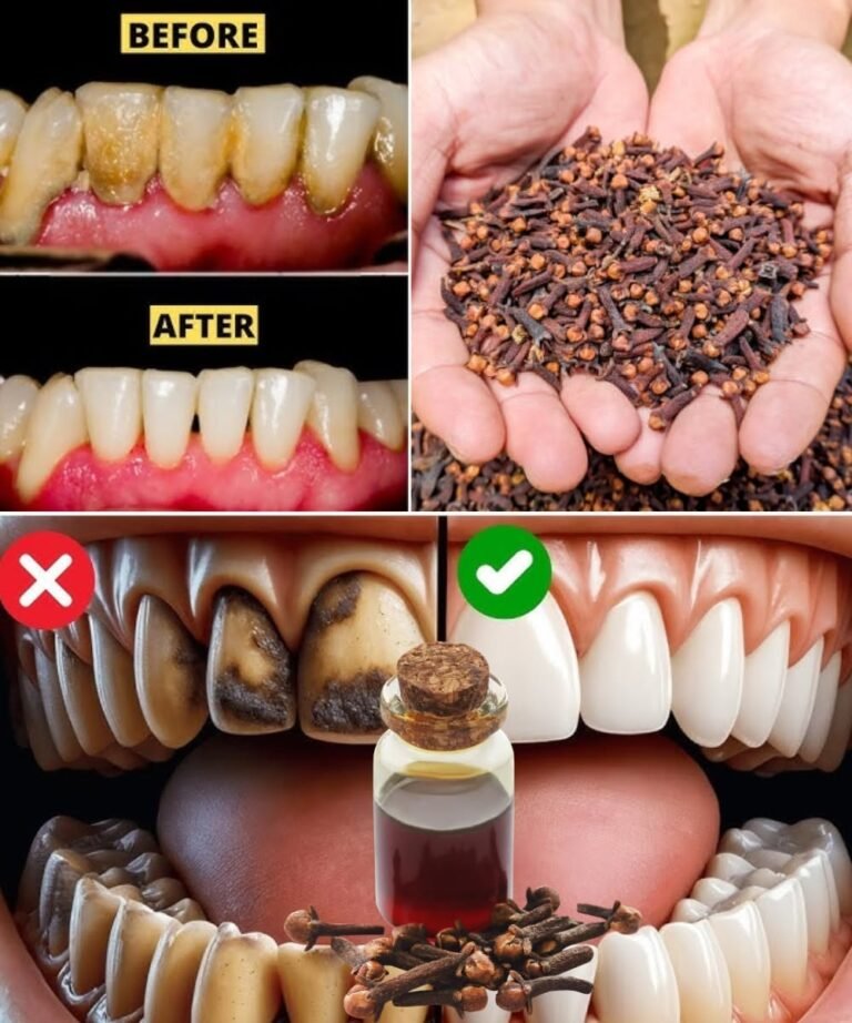 Unlock the Secret to Healthier Teeth with the Oral Care Benefits of Chewing Cloves Daily