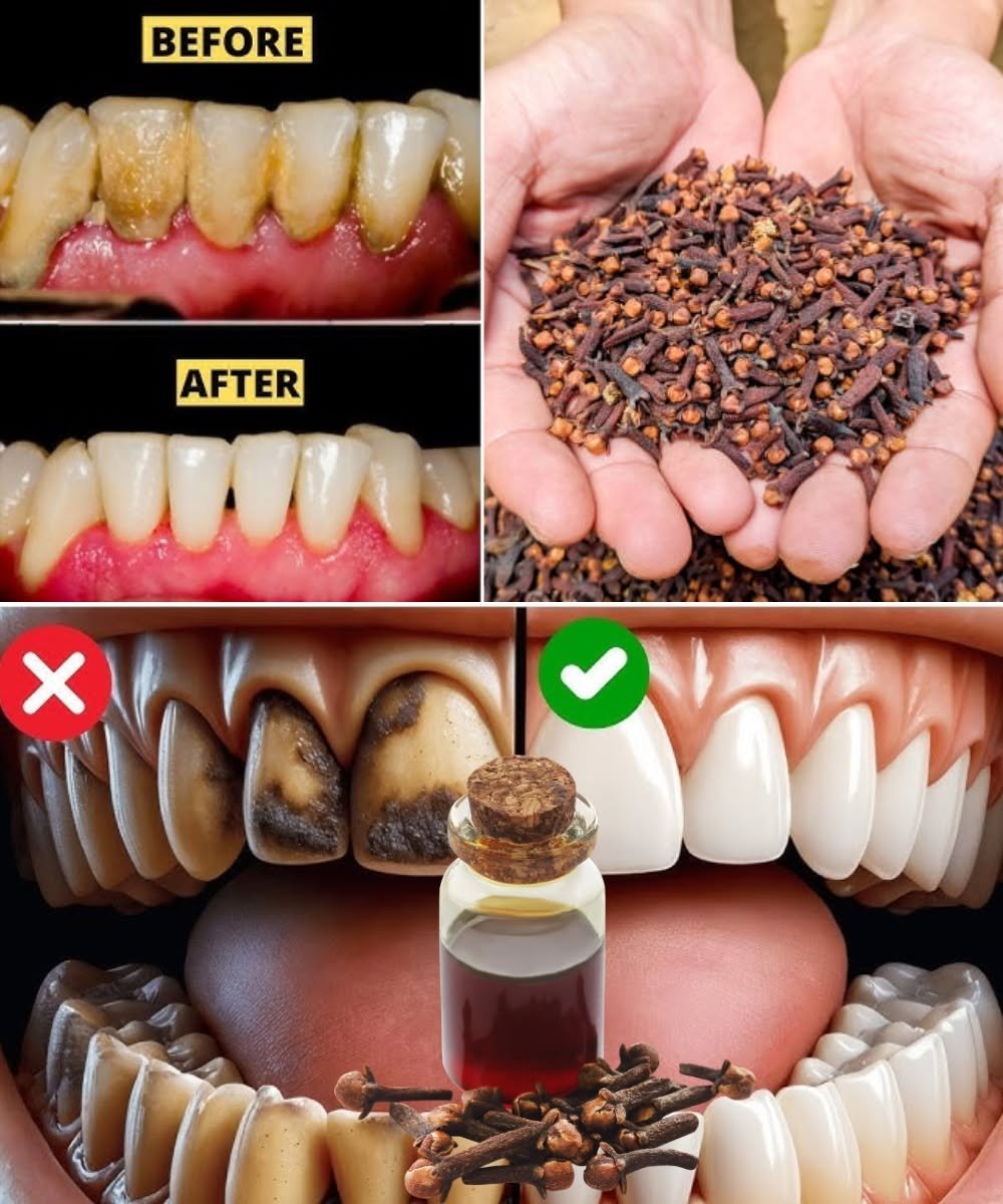 Unlock the Secret to Healthier Teeth with the Oral Care Benefits of Chewing Cloves Daily