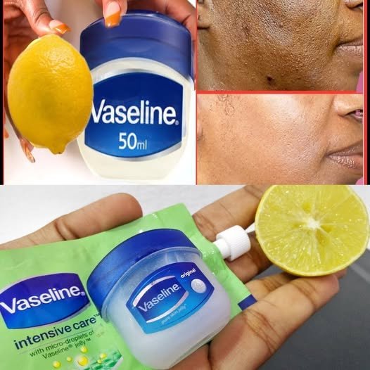 Vaseline and Lemon for Skin: Does This DIY Remedy Really Work?