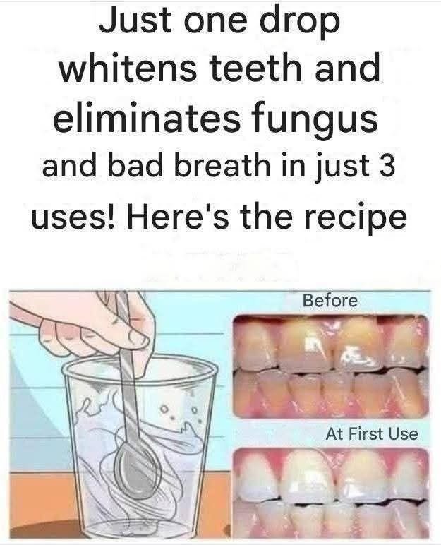 Can You Remove Tartar and Whiten Teeth at Home? What Actually Works
