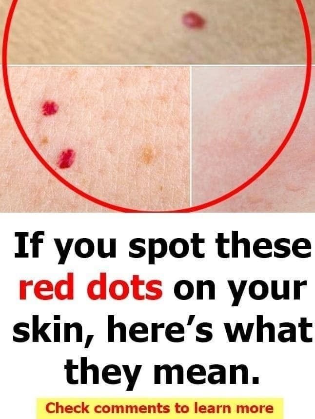 What Do Red Dots on Your Skin Mean? Common Causes, Warning Signs, and When to See a Doctor