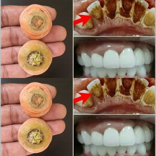 Can Carrots Naturally Whiten Your Teeth? Here's What the Evidence Says
