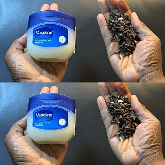 Cloves and Petroleum Jelly: What Are the Potential Benefits?