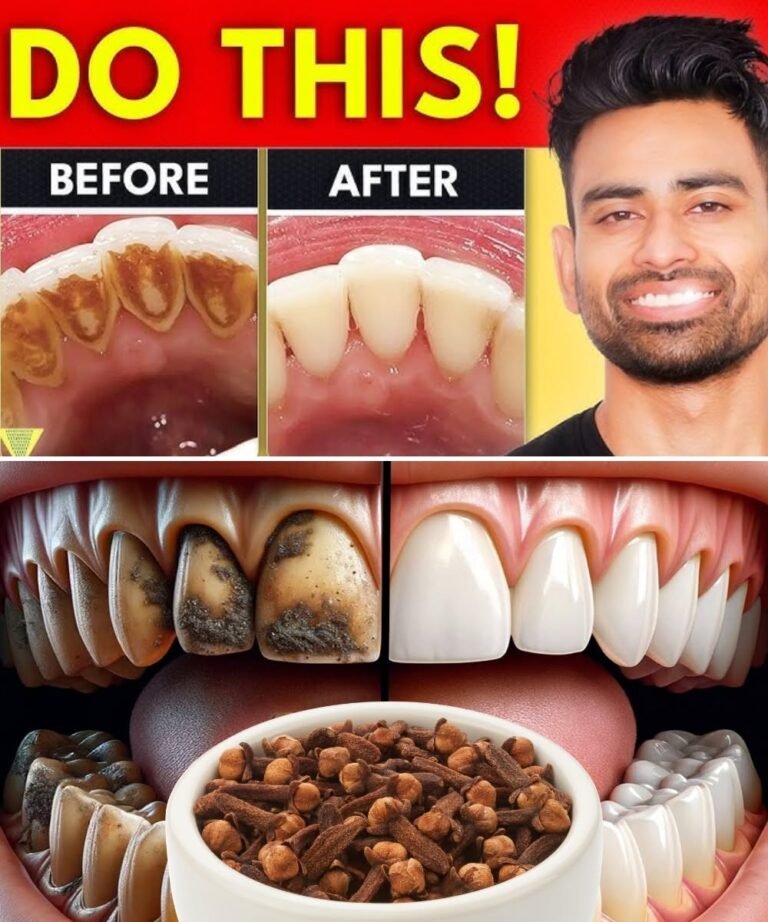 9 Natural Ways to Remove Plaque & Tartar Buildup