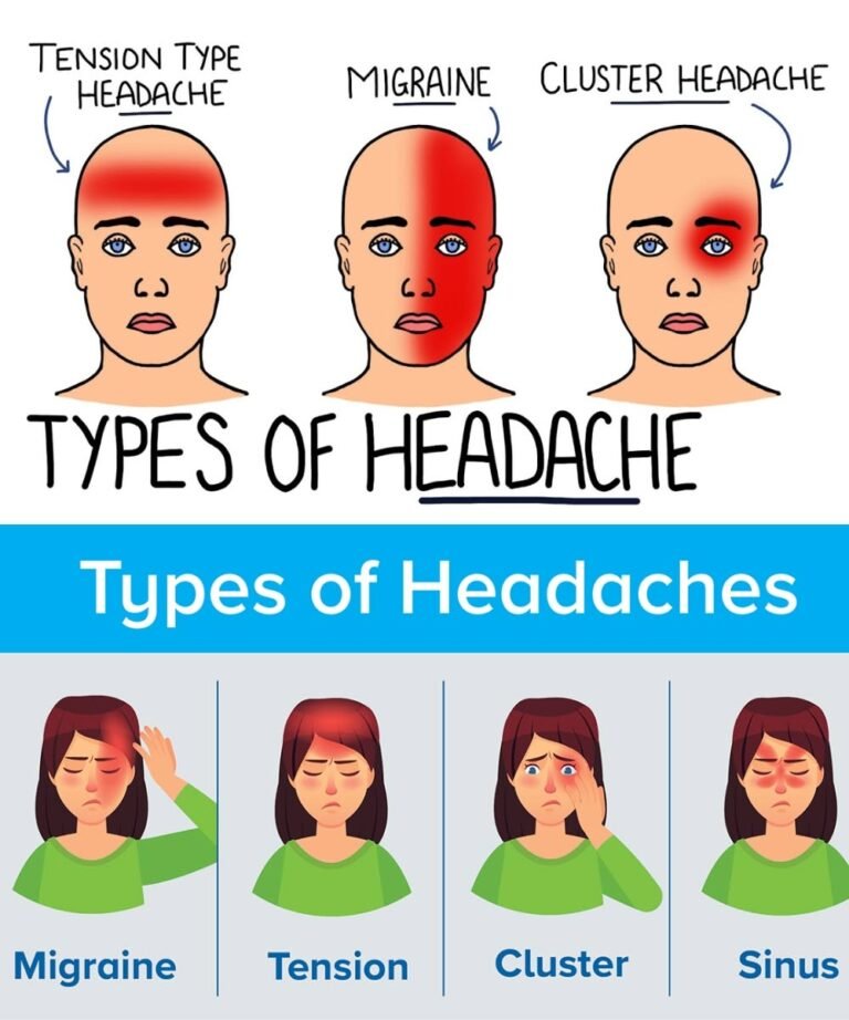 10 Different Types of Headaches and What Causes Them (Plus Natural Remedies)
