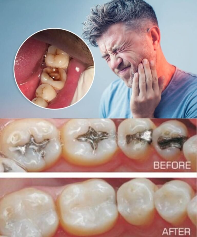 Say Goodbye to Cavities: Natural Ways to Keep Your Teeth Strong and Healthy 🦷✨