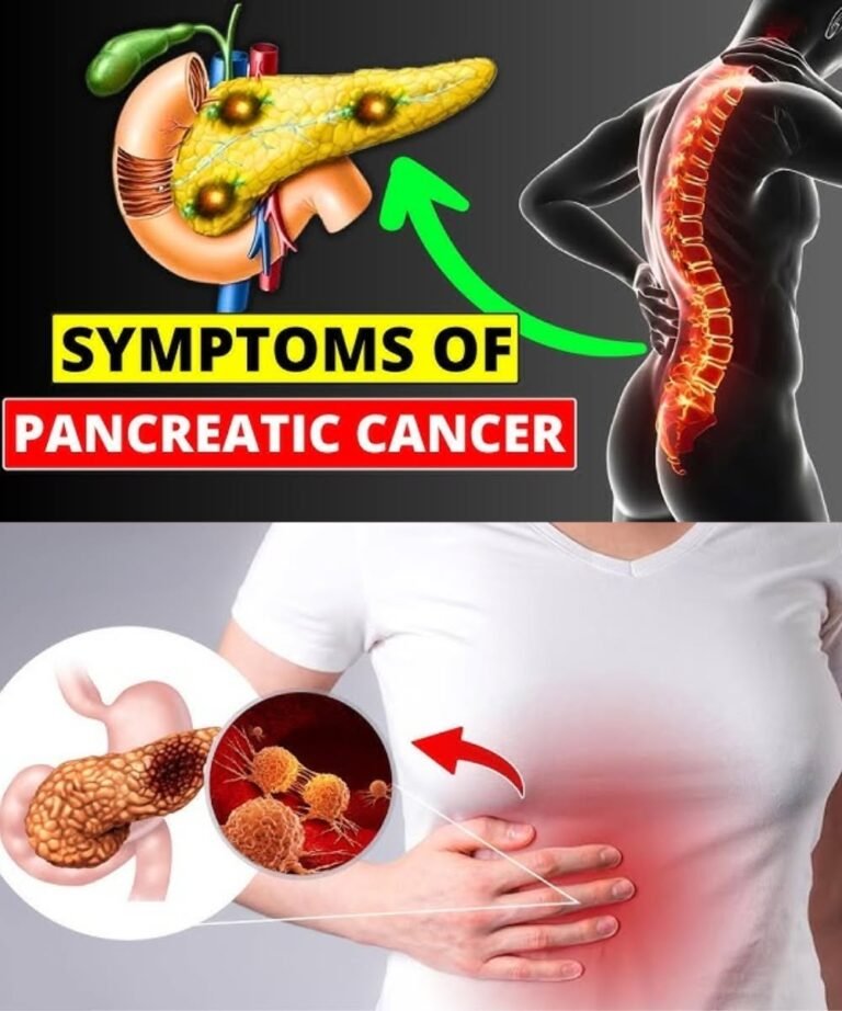 8 Shocking Symptoms of Pancreatic Cancer You Should NEVER Ignore | Early Warning Signs