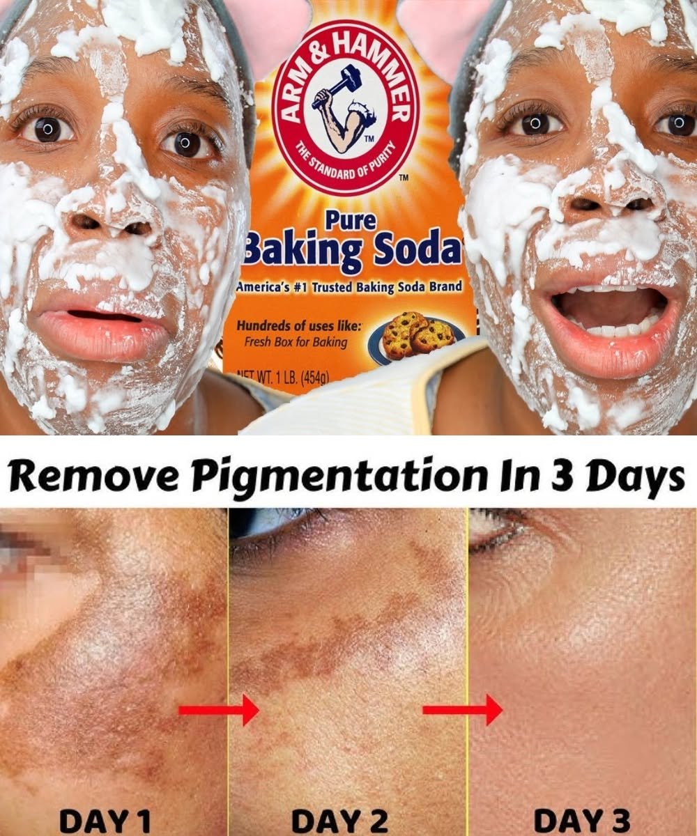 Homemade Baking Soda Cream for Wrinkles and Dark Spots: What You Should Know ✨