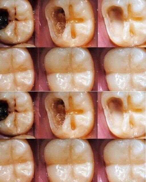 Natural Tips to Support Strong, Healthy Teeth – The Gentle Way to Care for Your Smile