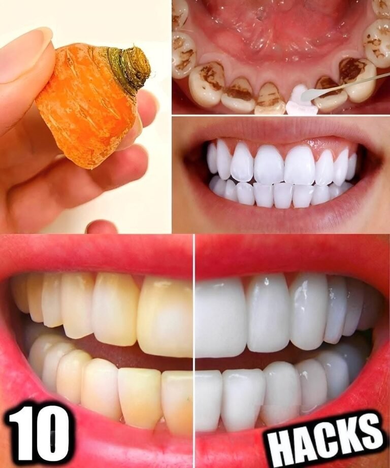 10 Natural Hacks to Whiten Your Teeth at Home in Just 3 Days (No Dentist Needed)