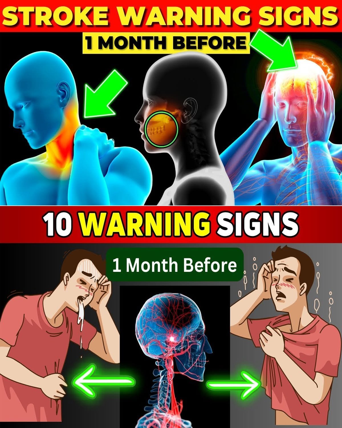 Spot Stroke Signs and Protect Your Health