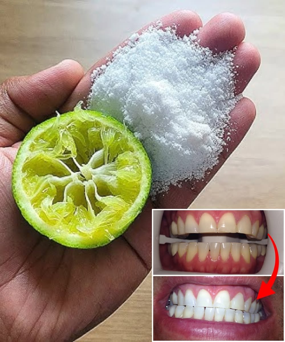 ✨ Unlock a Dazzling Smile: Natural Teeth Whitening Secrets You’ll Wish You Knew Sooner