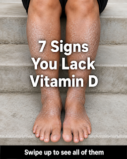 7 Signs Your Body May Be Low in Vitamin D: What to Watch For and How to Support Healthy Levels Naturally