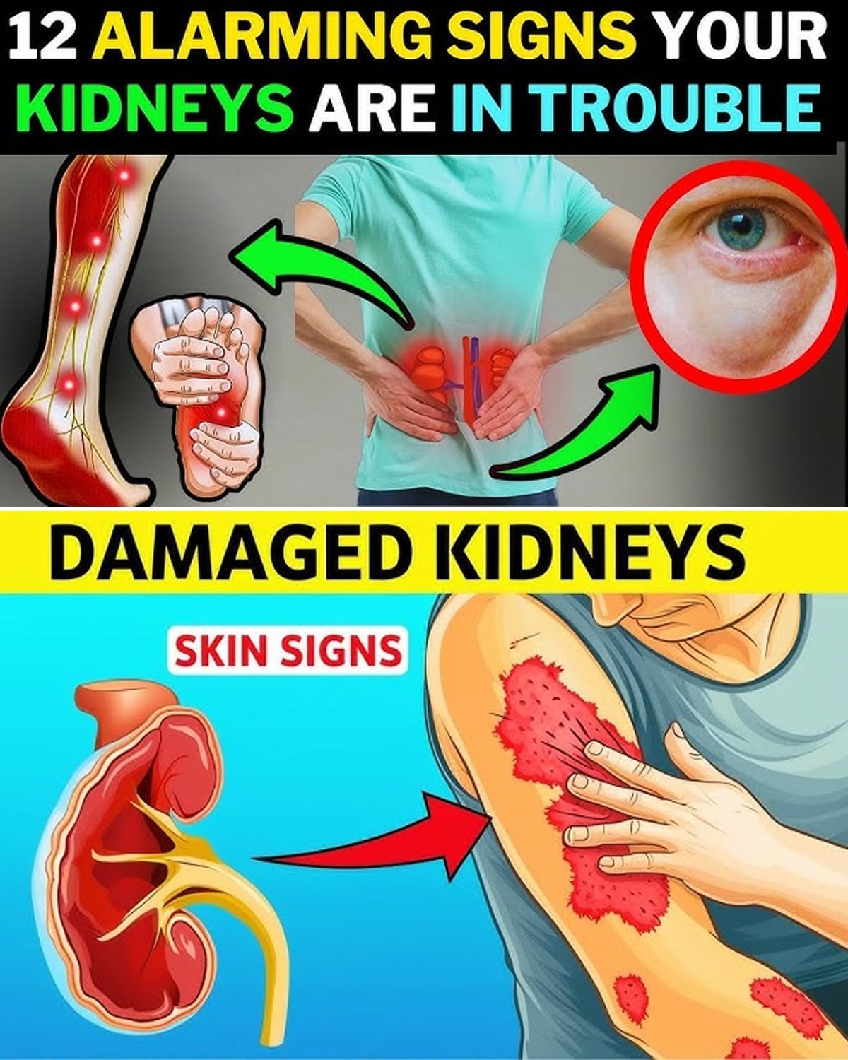 23 Subtle Signs Your Kidneys Might Be in Trouble (And You Probably Ignore Them)