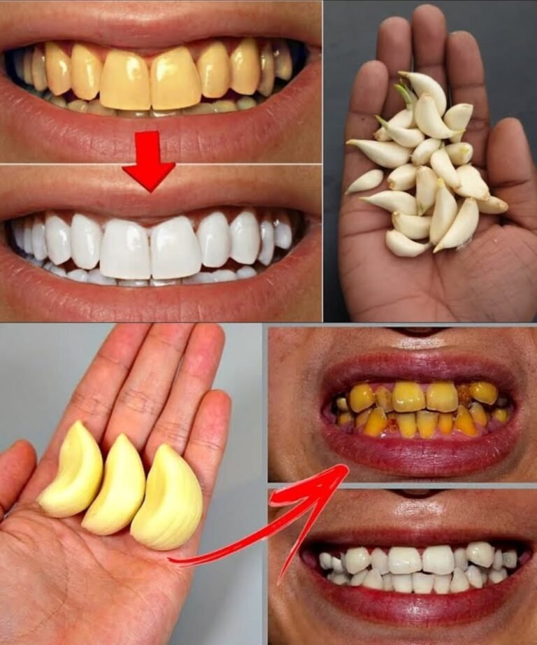 Improve Your Oral Health Naturally with Garlic