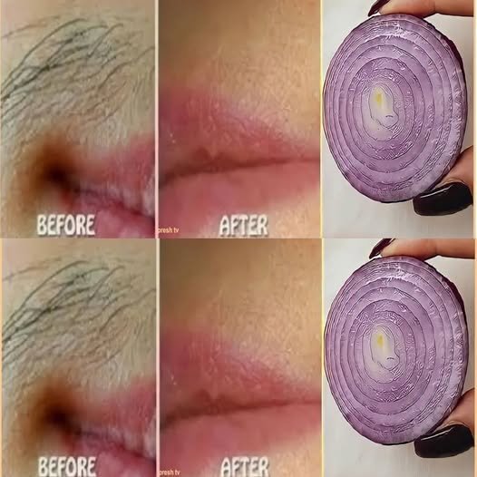Remove Unwanted Facial Hair Permanently with Onion: A Quick and Natural Remedy