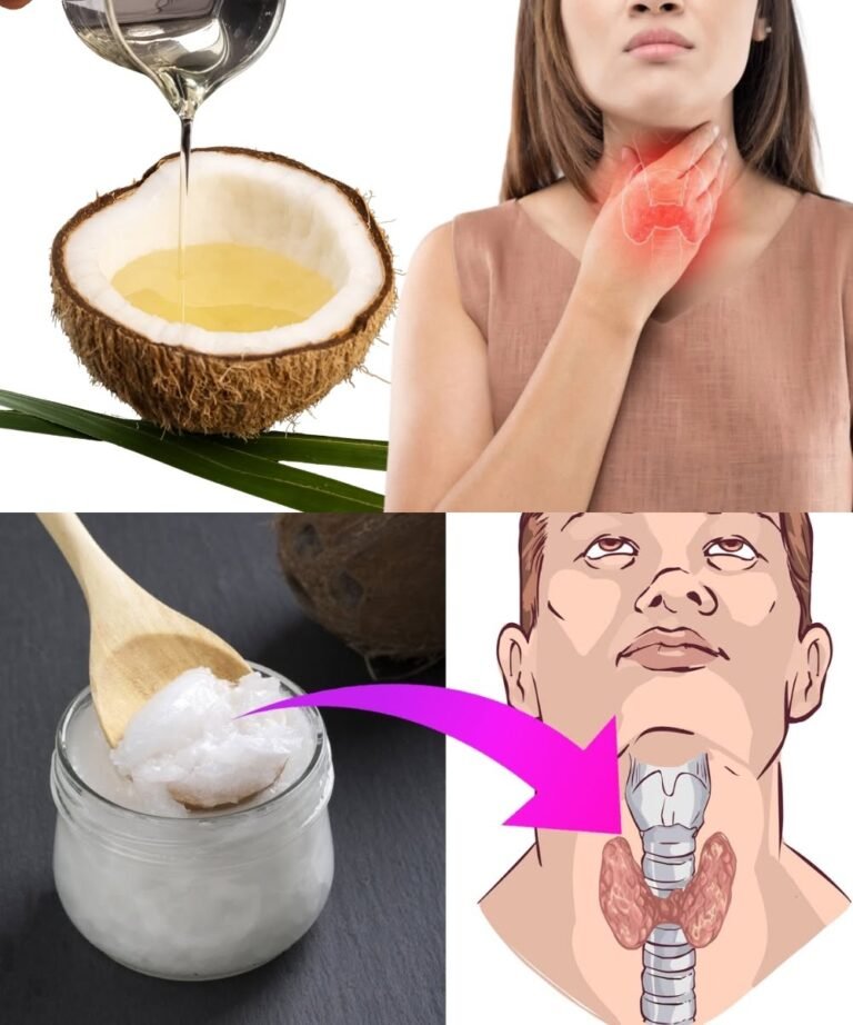 6 Ways Coconut Oil Can Benefit Those With Thyroid Problems
